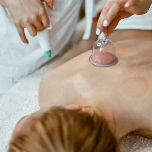 medicupping class, massage cup, vacuum therapy
